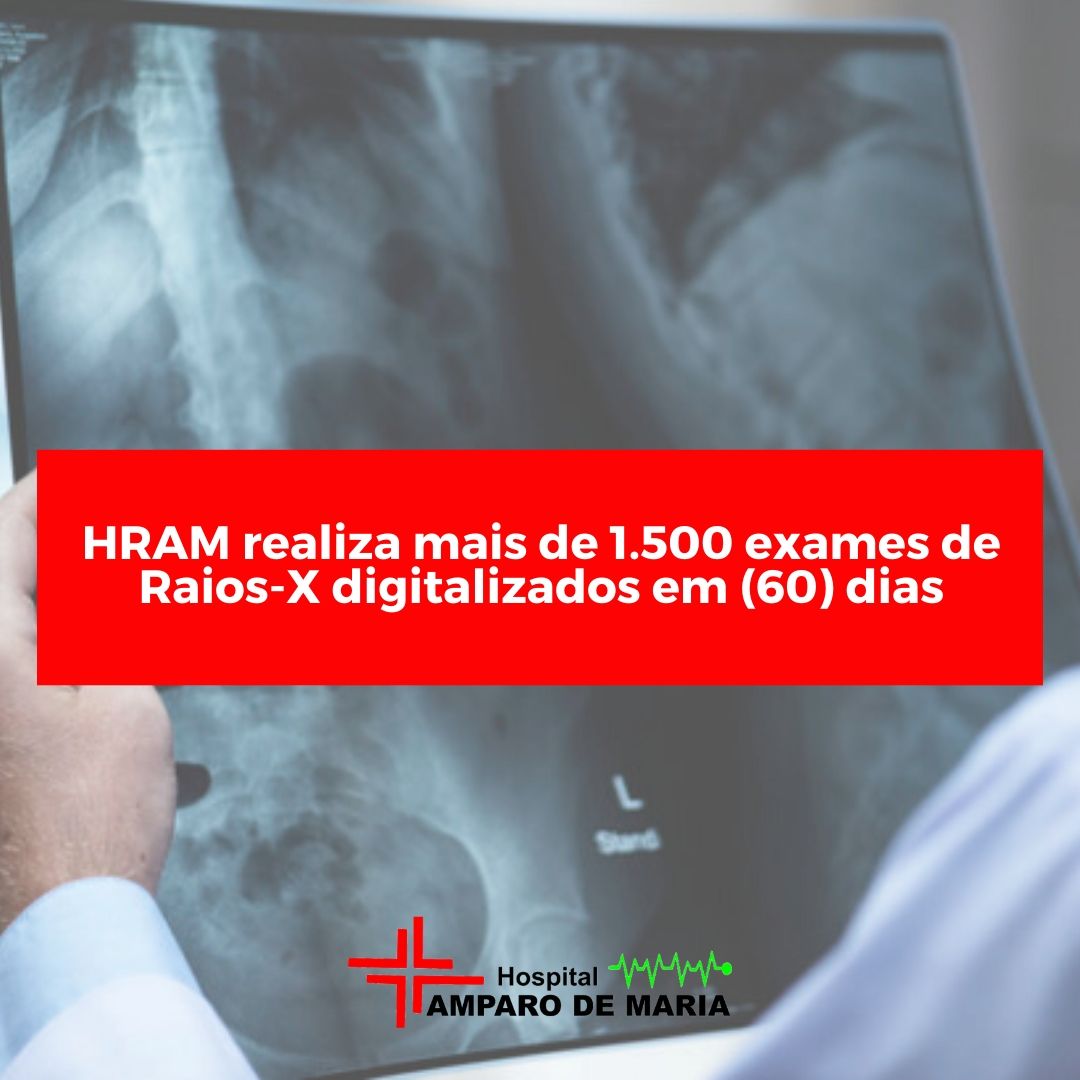 HRAM realiza mais de um mil e quinhentos exames de raios-x digitalizados em 60 dias.